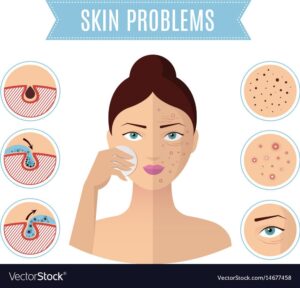 How to treat skin problems.