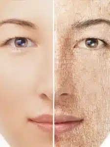 Best moisturizers for Dry Skin.