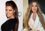 Khloe Kardashian Plastic Surgery