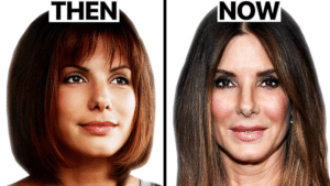 Sandra Bullock Plastic Surgery
