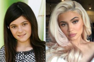 Kylie Jenner Before Plastic Surgery: The Beauty Mogul's Early Days